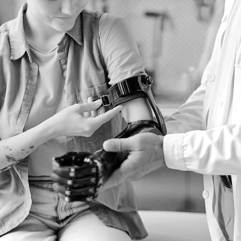 Doctor helping patient wear prosthetic arm